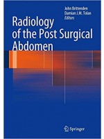 Radiology of the Post Surgical Abdomen