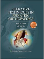 Operative Techniques in Pediatric Orthopaedics