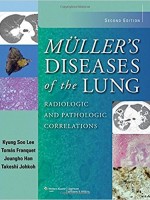Muller's Diseases of the Lung,2/e: Radiologic & Pathologic Correlations