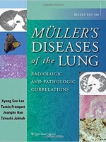 Muller's Diseases of the Lung,2/e: Radiologic & Pathologic Correlations