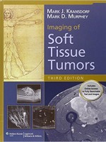 Imaging of Soft Tissue Tumors