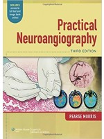 Practical Neuroangiography,3/e