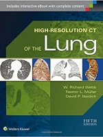 High-Resolution CT of the Lung, 5/e