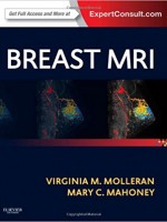 Breast MRI