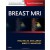 Breast MRI