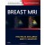 Breast MRI