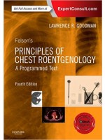 Felson's Principles of Chest Roentgenology, A Programmed Text,4/e