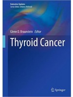 Thyroid Cancer