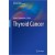 Thyroid Cancer