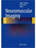 Neuromuscular Imaging