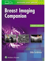 Breast Imaging Companion , 4e