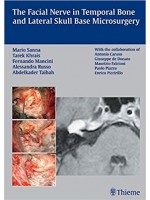 The Facial Nerve in Temporal Bone and Lateral Skull Base Microsurgery