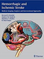 Hemorrhagic and Ischemic Stroke