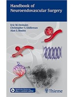 Handbook of Neuroendovascular Surgery