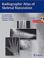 Radiographic Atlas of Skeletal Maturation