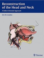 Reconstruction of the Head and Neck: A Defect-Oriented Approach