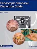 Endoscopic Sinonasal Dissection Guide