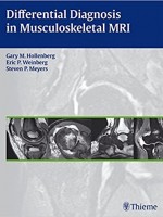Differential Diagnosis in Musculoskeletal MRI