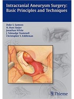 Intracranial Aneurysm Surgery: Basic Principles and Techniques