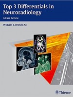 Top 3 Differentials in Neuroradiology