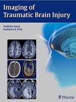 Imaging of Traumatic Brain Injury