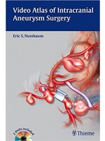 Video Atlas of Intracranial Aneurysm Surgery