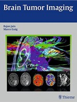 Brain Tumor Imaging