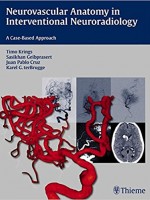 Neurovascular Anatomy in Interventional Neuroradiology: A Case-Based Approach