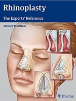 Rhinoplasty : The Experts' Reference