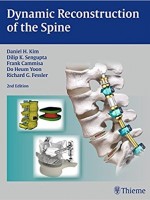 Dynamic Reconstruction of the Spine