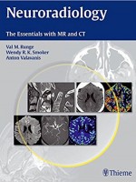 Neuroradiology; The Essentials With MR and CT