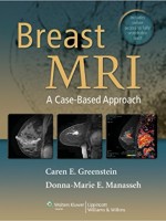 Breast MRI: A Case-Based Approach