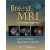 Breast MRI: A Case-Based Approach