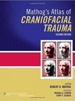 Mathog's Atlas of Craniofacial Trauma, 2e