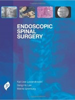 Endoscopic Spinal Surgery