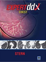 Expert Differential Diagnoses: Chest