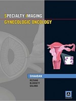 Specialty Imaging: Gynecologic Oncology