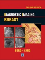 Diagnostic Imaging:Breast,2/e