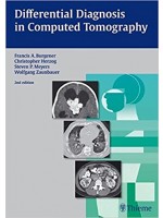 Differential Diagnosis in Computed Tomography