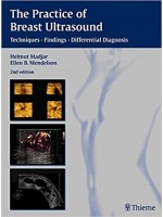 The Practice of Breast Ultrasound (Techniques, Findings, Differential Diagnosis)