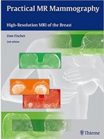 Practical MR Mammography: High-Resolution MRI of the Breast