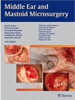 Middle Ear and Mastoid Microsurgery , 2/e