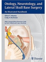 Otology, Neurotology, and Lateral Skull Base Surgery: An Illustrated Handbook