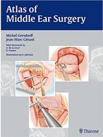 Atlas of Middle Ear Surgery