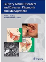 Salivary Gland Disorders & Diseases: Diagnosis & Management
