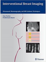 Interventional Breast Imaging: Ultrasound, Mammography & MR Guidance Techniques