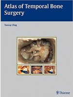 Atlas of Temporal Bone Surgery