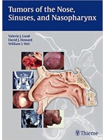 Tumors of the Nose, Sinuses and Nasopharynx