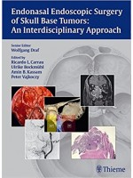 Endonasal Endoscopic Surgery of Skull Base Tumors