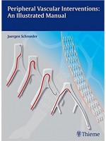 Peripheral Vascular Interventions: An Illustrated Manual